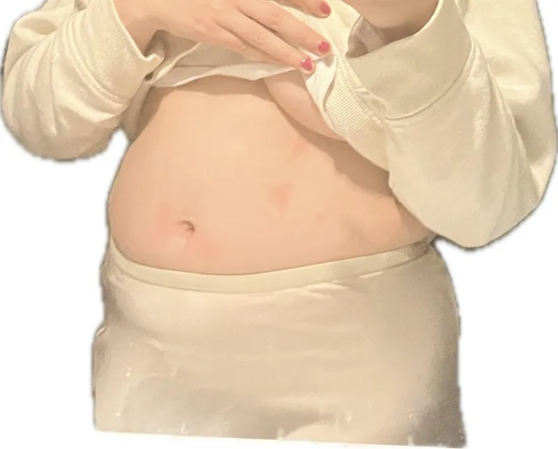 Thumbnail ballooningg Embracing the Journey to Being Officially Overweight | Stuffers Insight