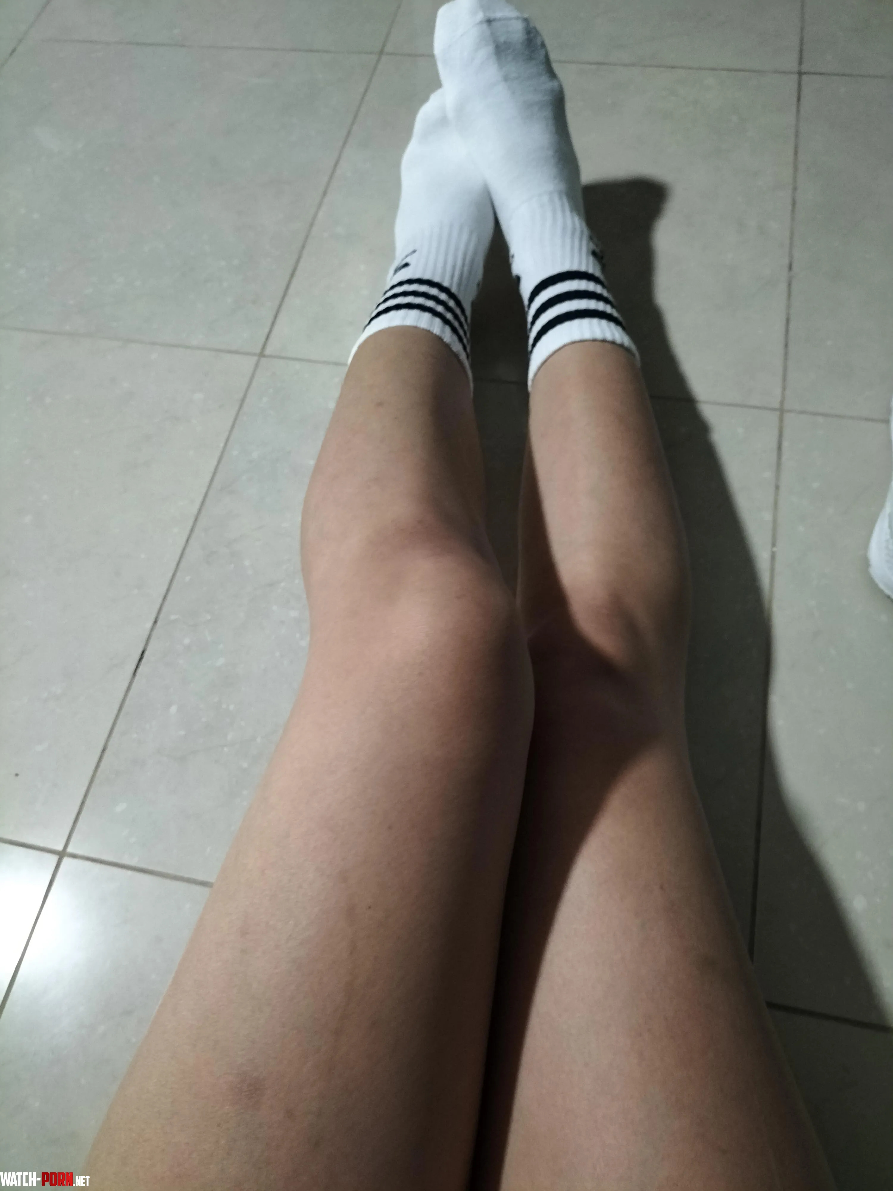 😂Some visible scars oppsssss by yums153
