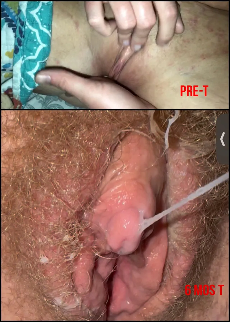Thumbnail BegginForMore's Big Clit Transformation Story: Energy, Health & Desires