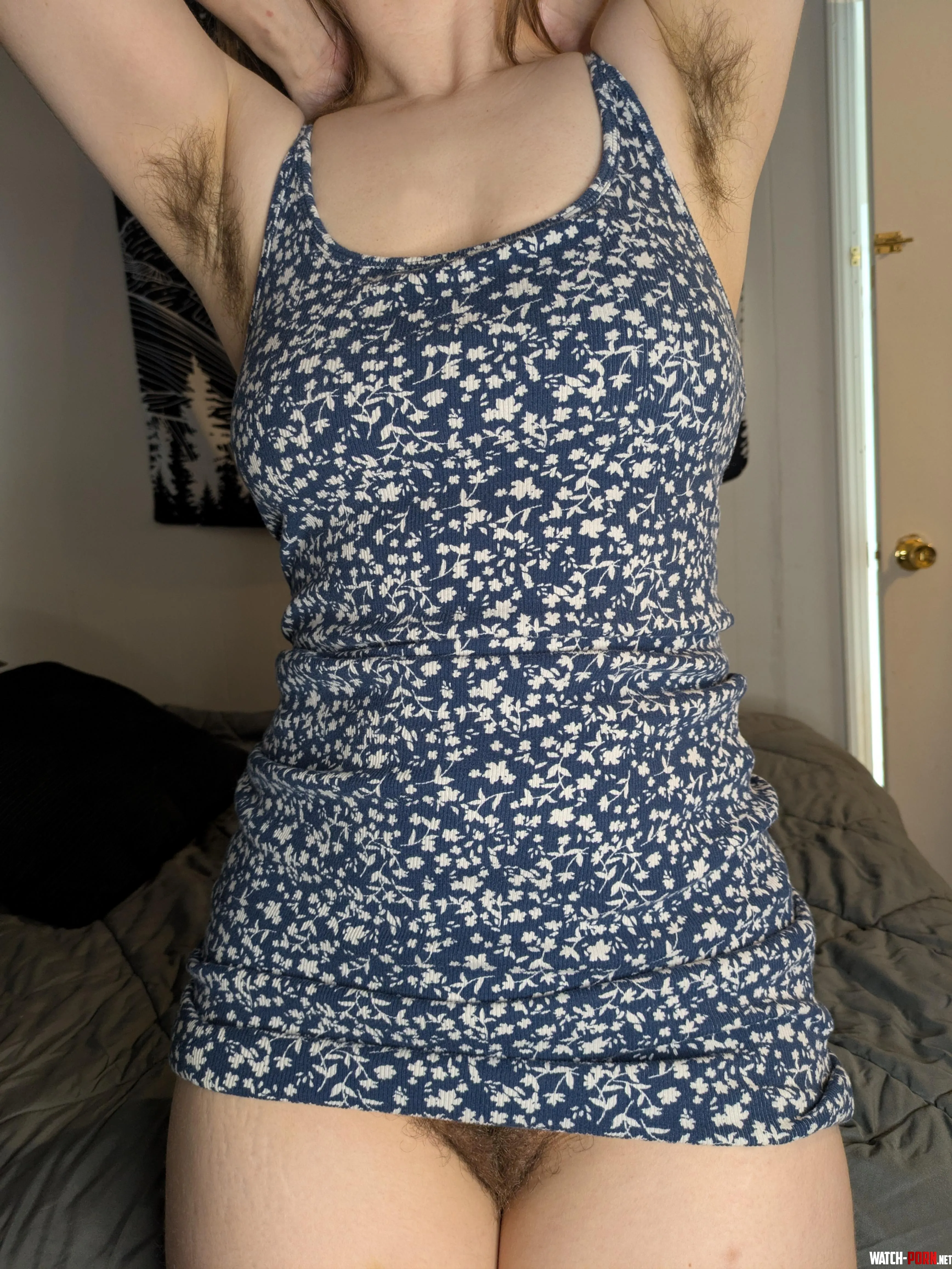 I know you all love hairy sundress season by SisterSleeze