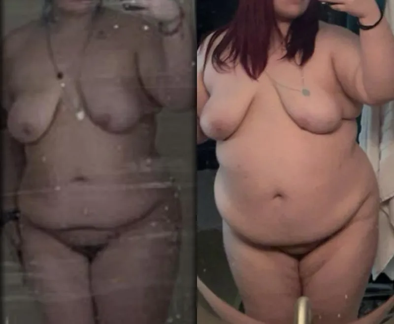 Thumbnail Eye-Opening Photos Shared by Starphucker | wgbeforeafter