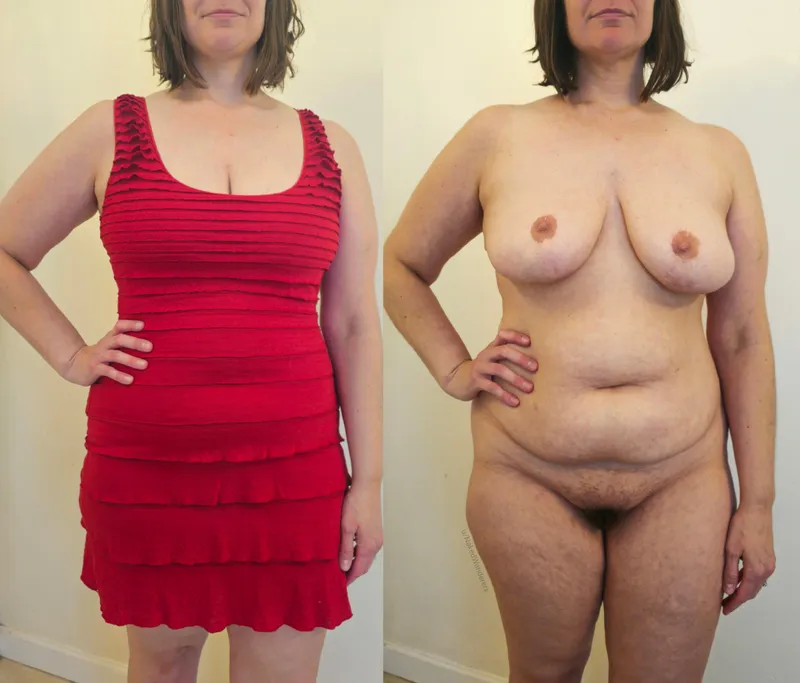 Thumbnail Dress Spoiler Alert: NakedWanderers Discloses in mombod Category