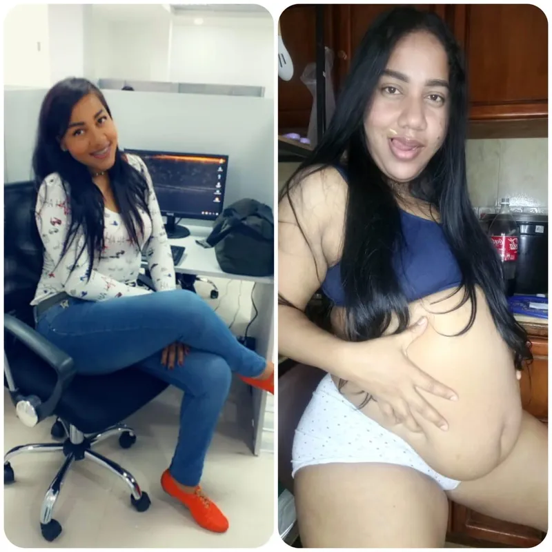 Thumbnail Flaunt the Change: Admiring Extra Pounds – chikiandrys93 in wgbeforeafter