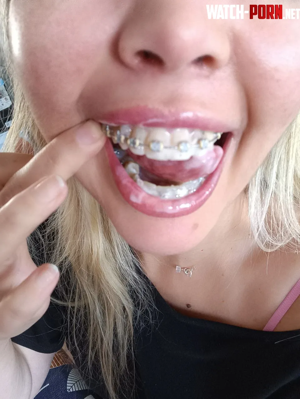He covered my braces with his delicious cum by Wandyerotic