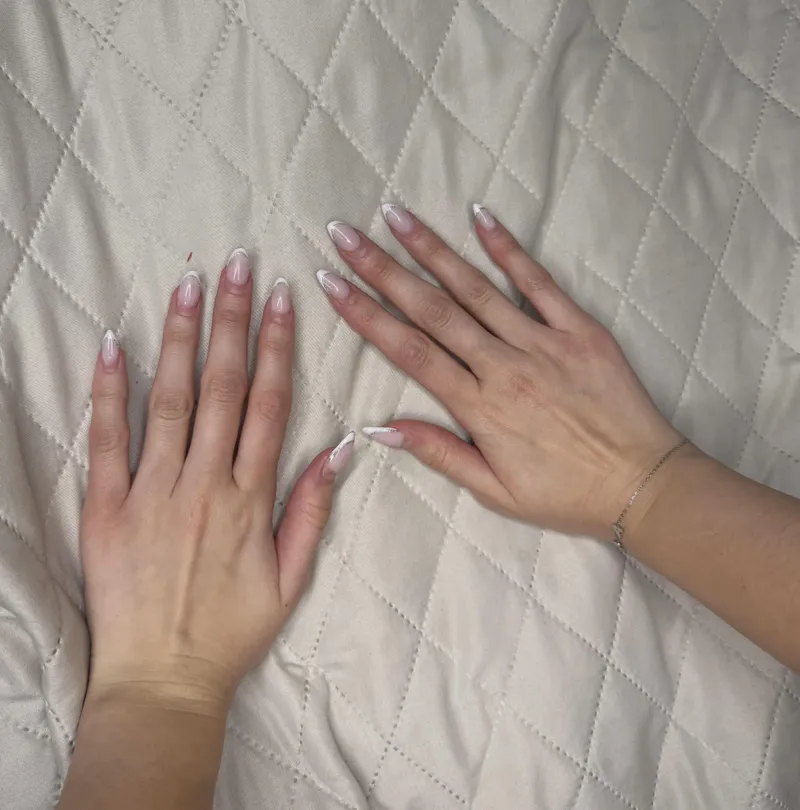 Thumbnail Explore the Mysterious World Behind Fingernails | Xavedkhan