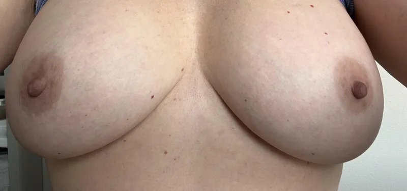 Thumbnail Euphoric-DJ76 Seeks Kind Opinions | RateMyBoobs