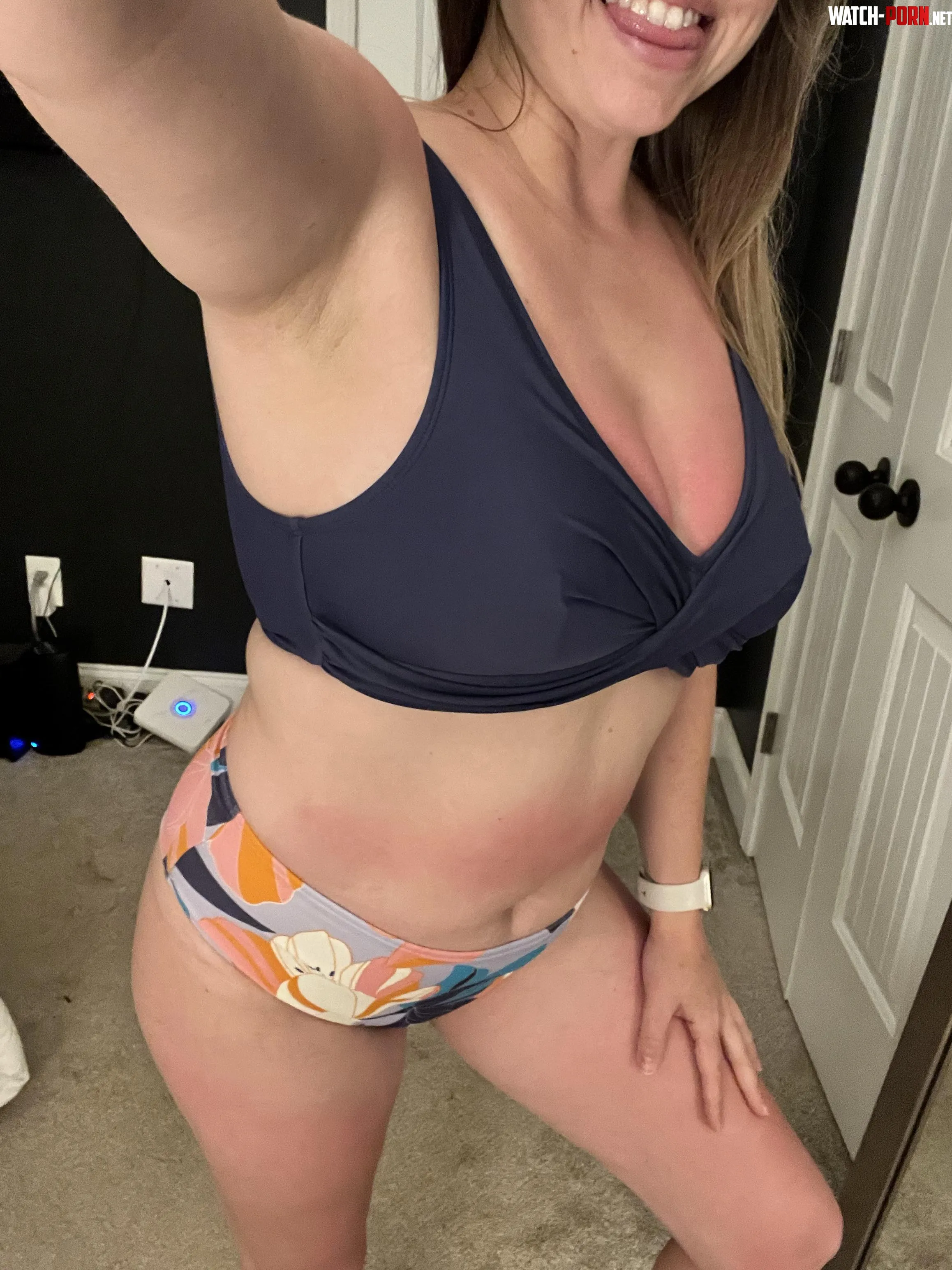 Got a little sunburnt last week, come rub allow on me by Sweet_Serendipity_69