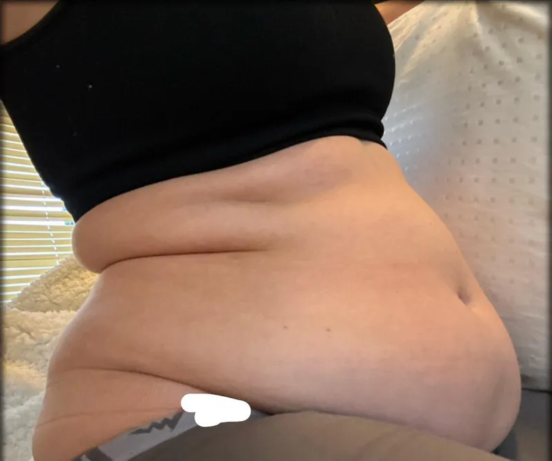 Thumbnail Fit_Camera_1131 Tackles Belly Fat with a Playful Apology