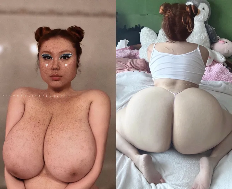 Thumbnail Unicornglitteryblood Celebrates Redheads with Freckles in Life