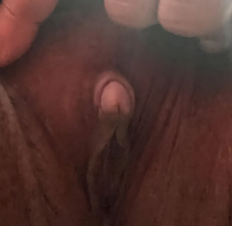 Thumbnail Obsession Alert: Growing Clit? by Mountain-Designer181
