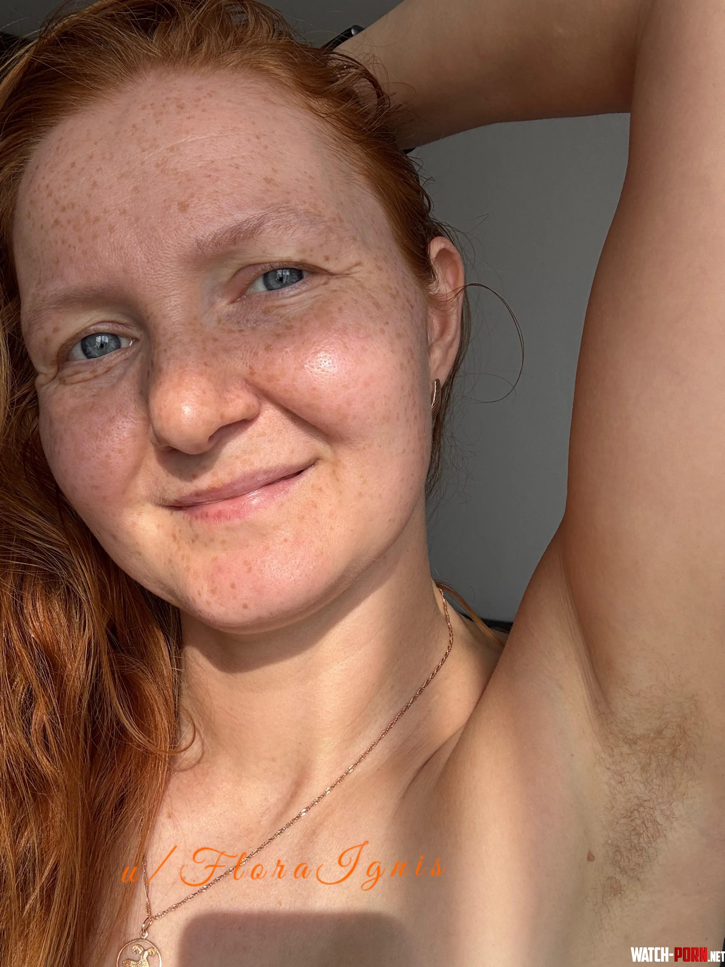 Just started growing out my little red hairs) by FloraIgnis