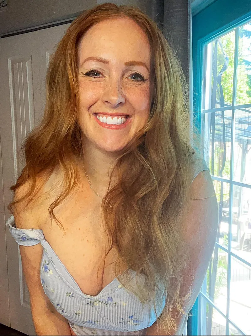 Thumbnail Summer Freckles Love: Embracing Unique Beauty | Nursedudz1980