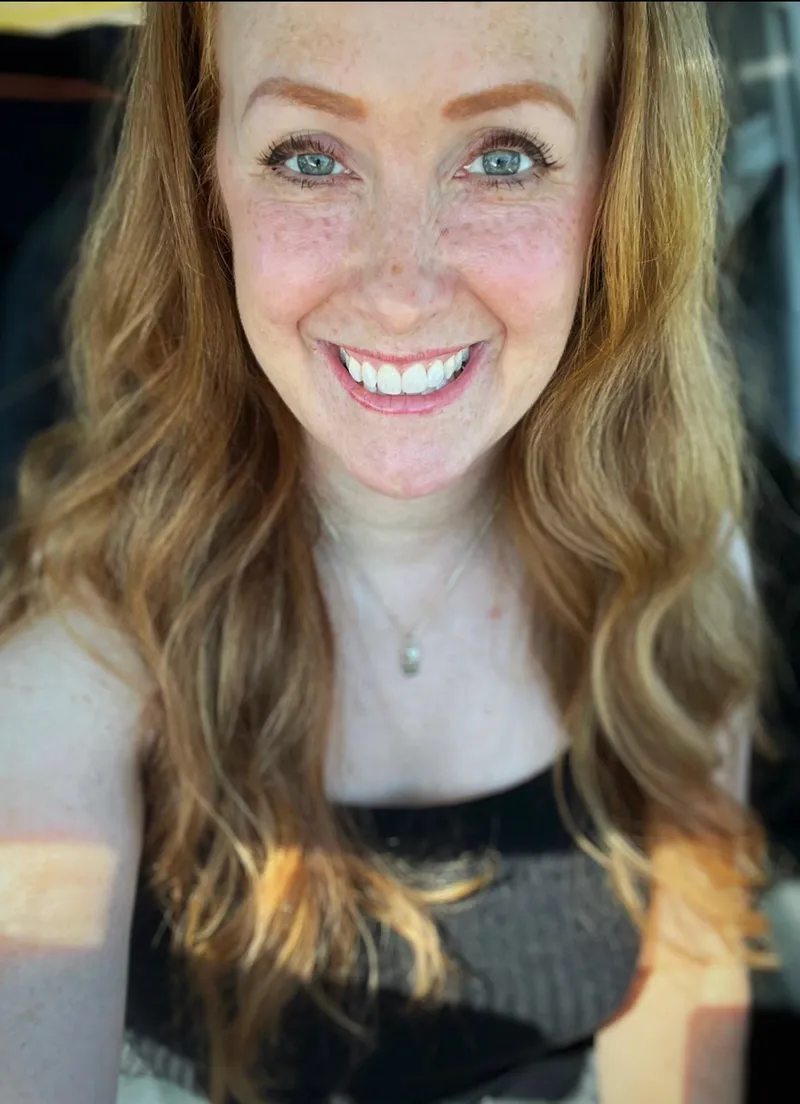 Thumbnail Adoring Freckles Today: Celebrating Unique Features | Nursedudz1980