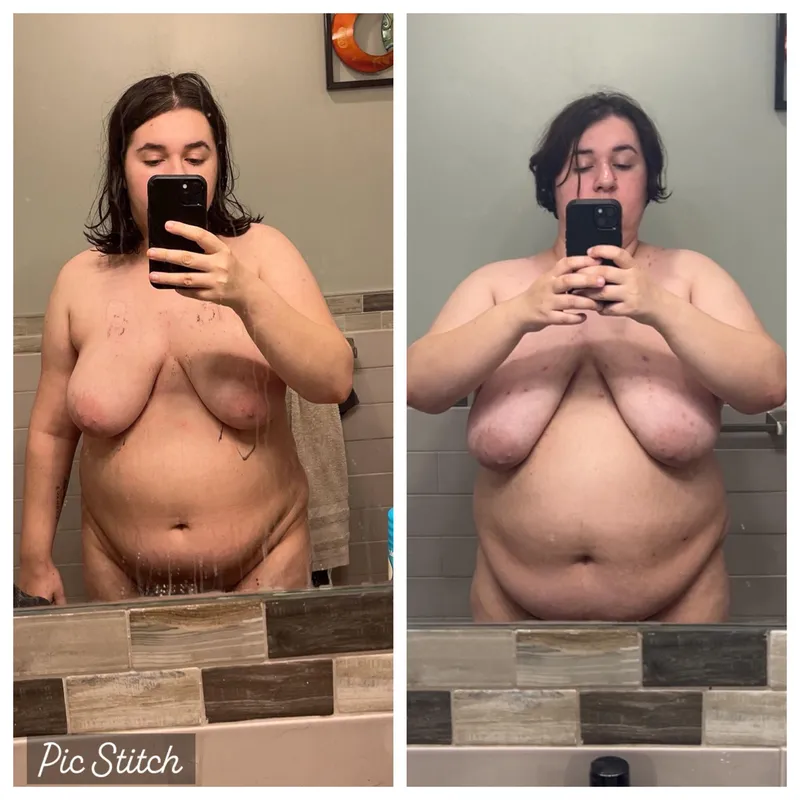Thumbnail Witness the Remarkable Fat Loss Journey - Before and After | ZaraGainer