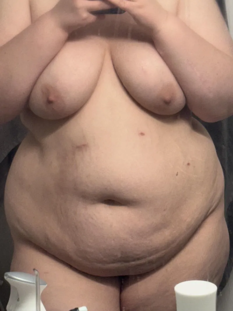 Thumbnail SlutsofOnlyFans Category: Girly's Comeback from Surgery: A Reveal by gallery_blue
