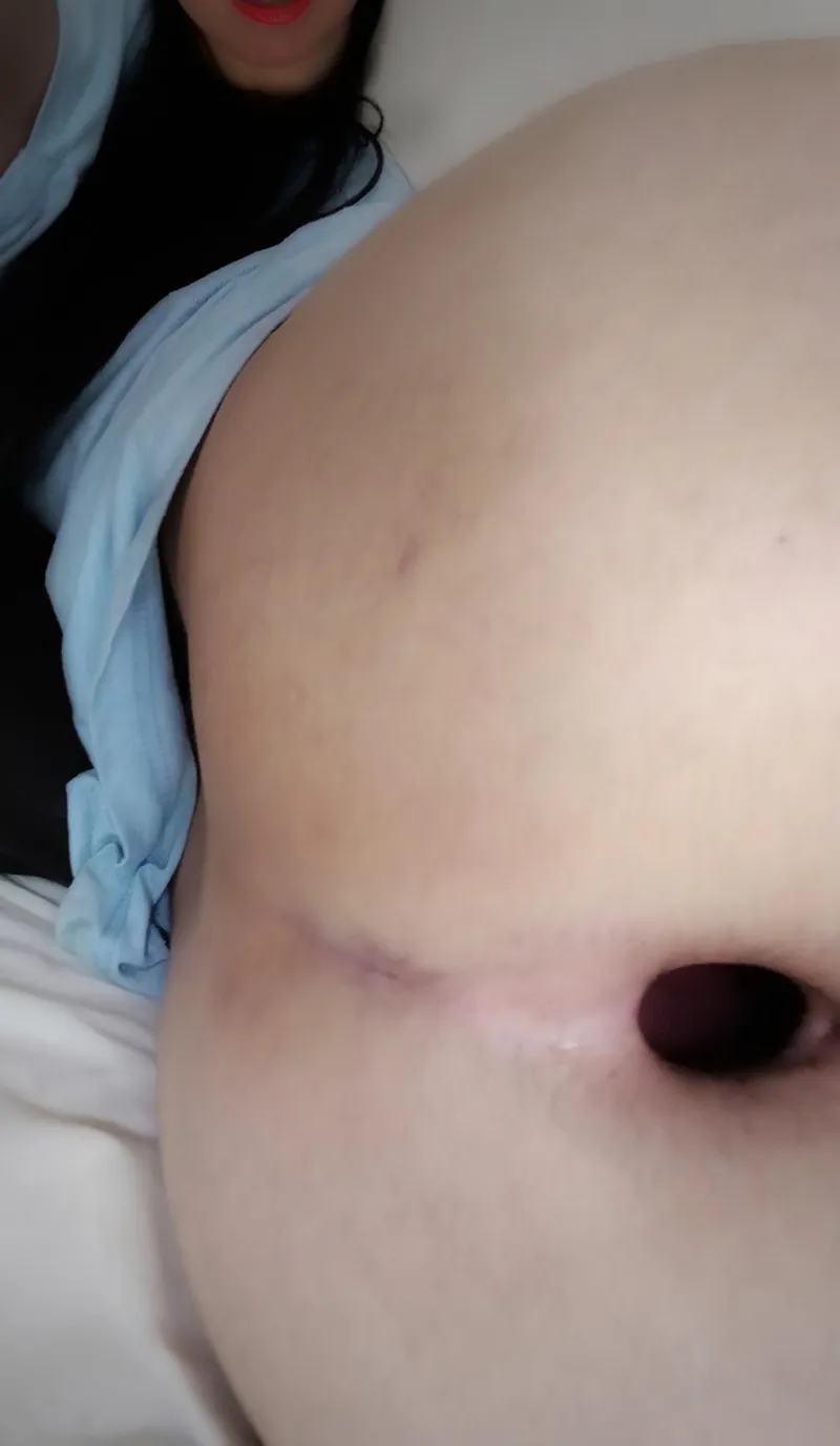 Thumbnail Exploring Butthole Kinks: An Intimate Account by soldaderyan