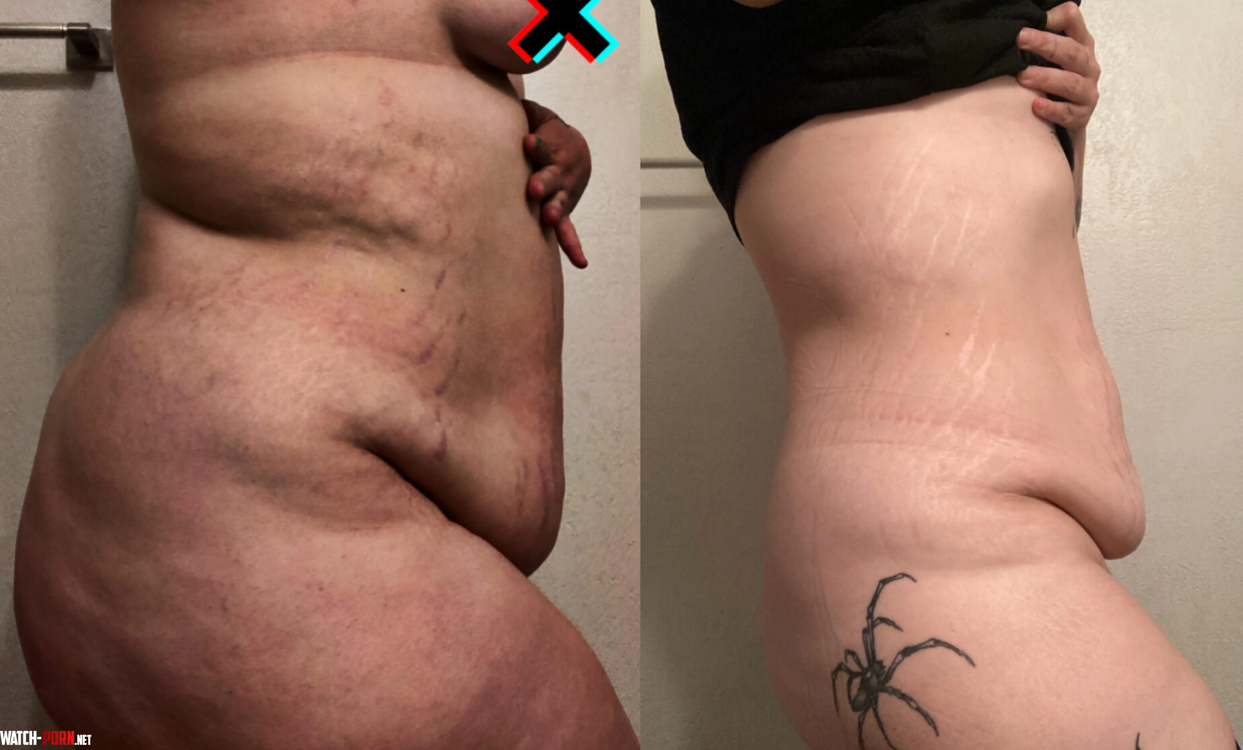 This goth slut lost 56lbs by BlackListBarbie