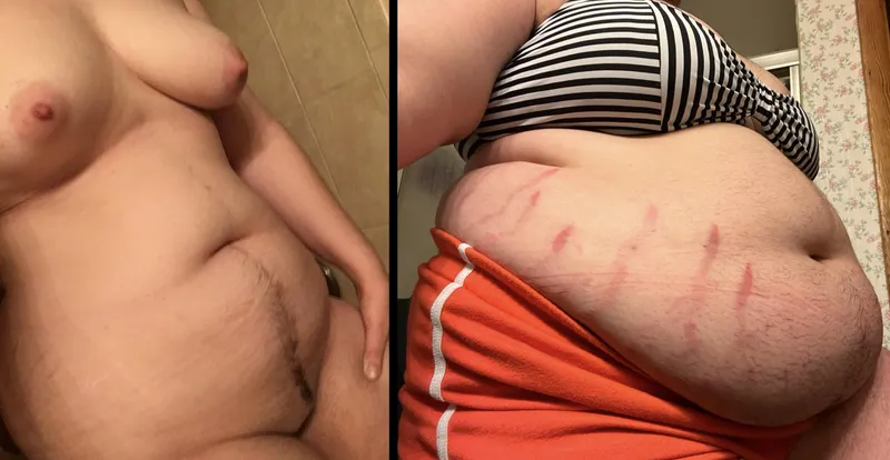 Thumbnail Soft & Proud: Discover thighyena's wgbeforeafter Transformation