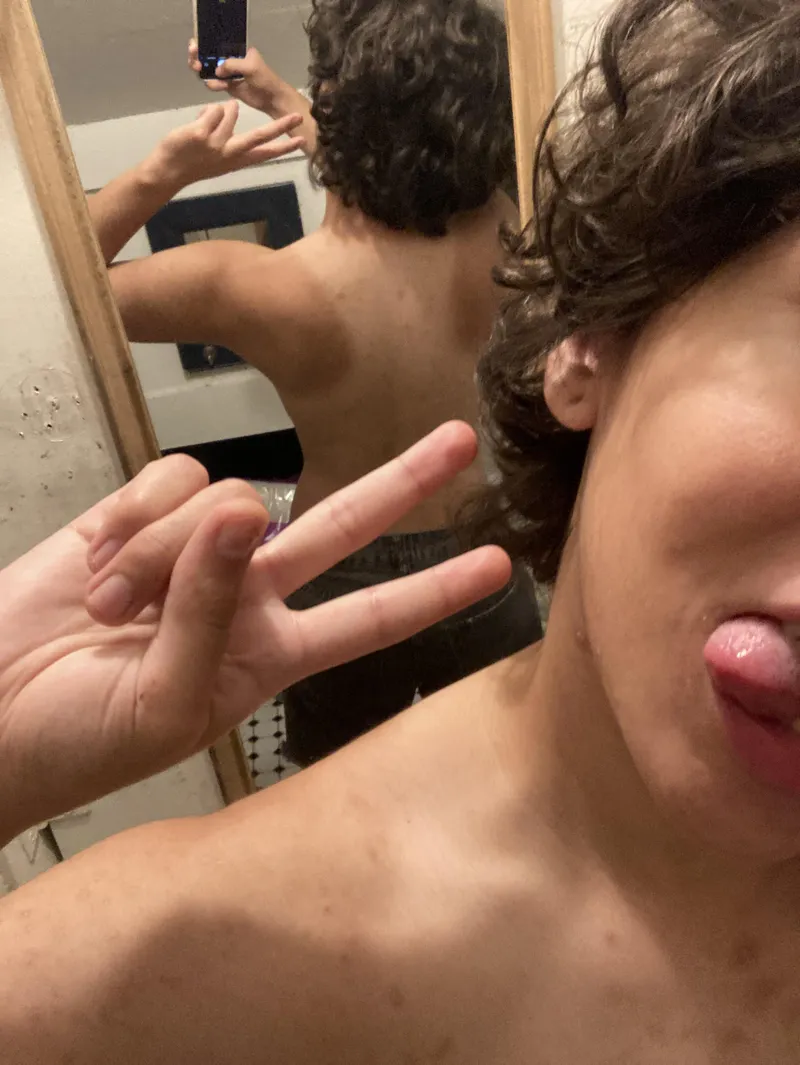 Thumbnail Feeling Sunburnt 🤧 by tomboij in Shorthairchicks Category