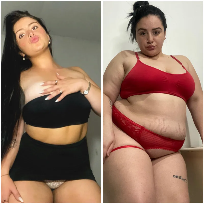 Thumbnail Am I Still Desirable? Explore cindytaa's wgbeforeafter Story
