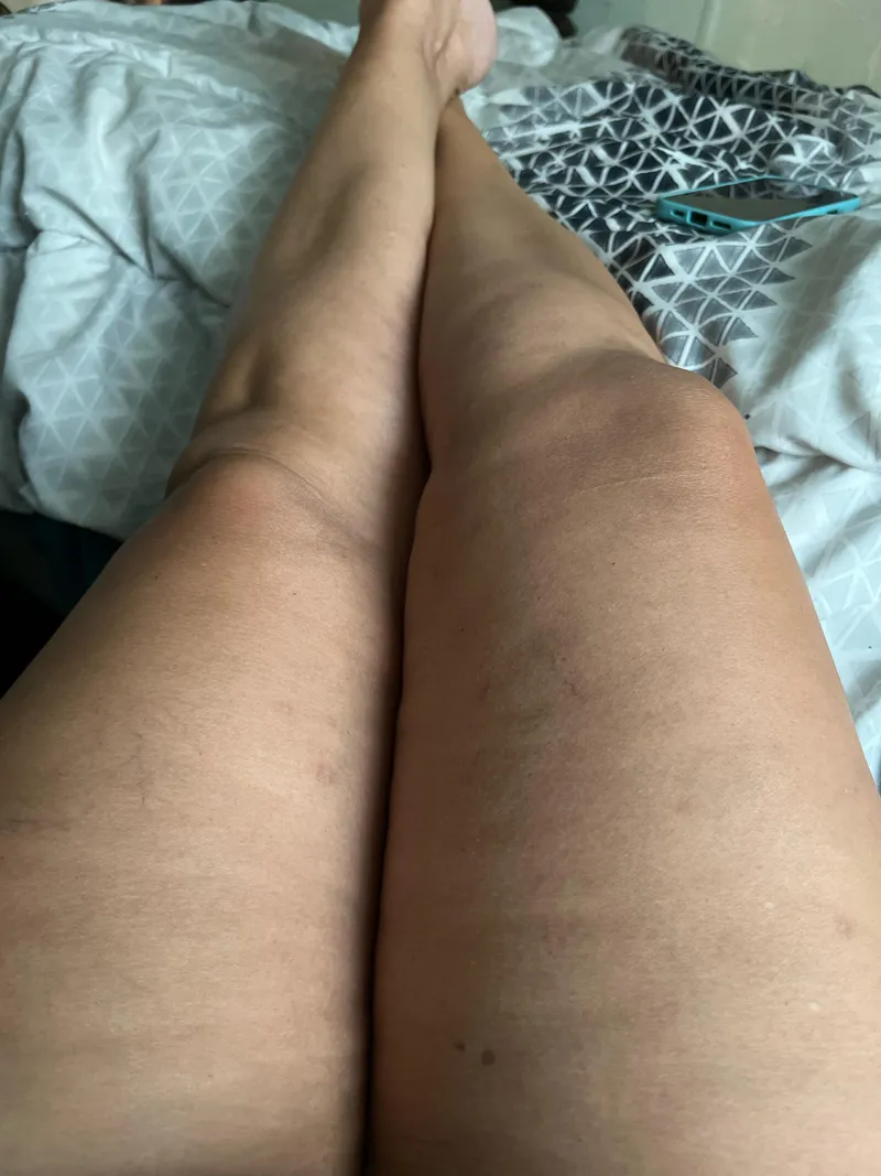 Thumbnail Visual Sensations: Unraveling the Seductive Mystery - OhMyCRose