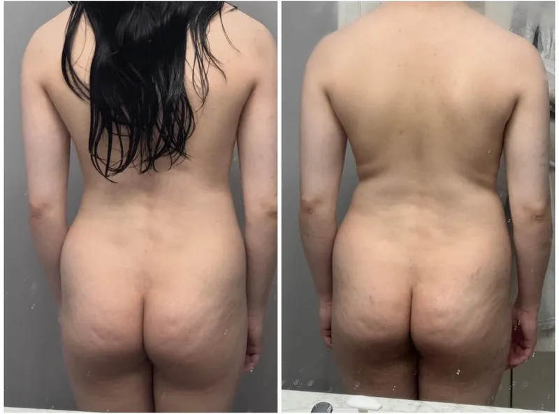 Thumbnail Transformation Journey: Embracing Body Changes | growingcanadiangirl