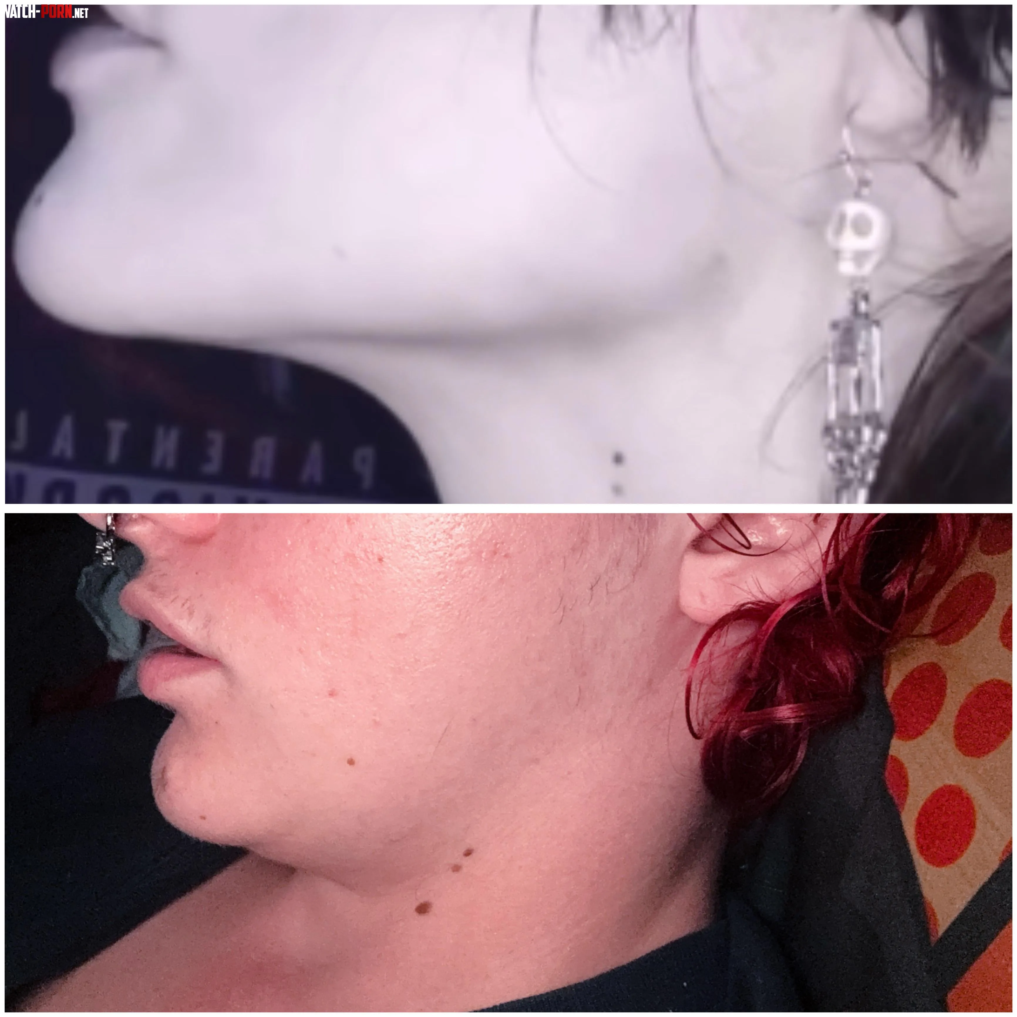 does my jawline still cut? by transbon3s