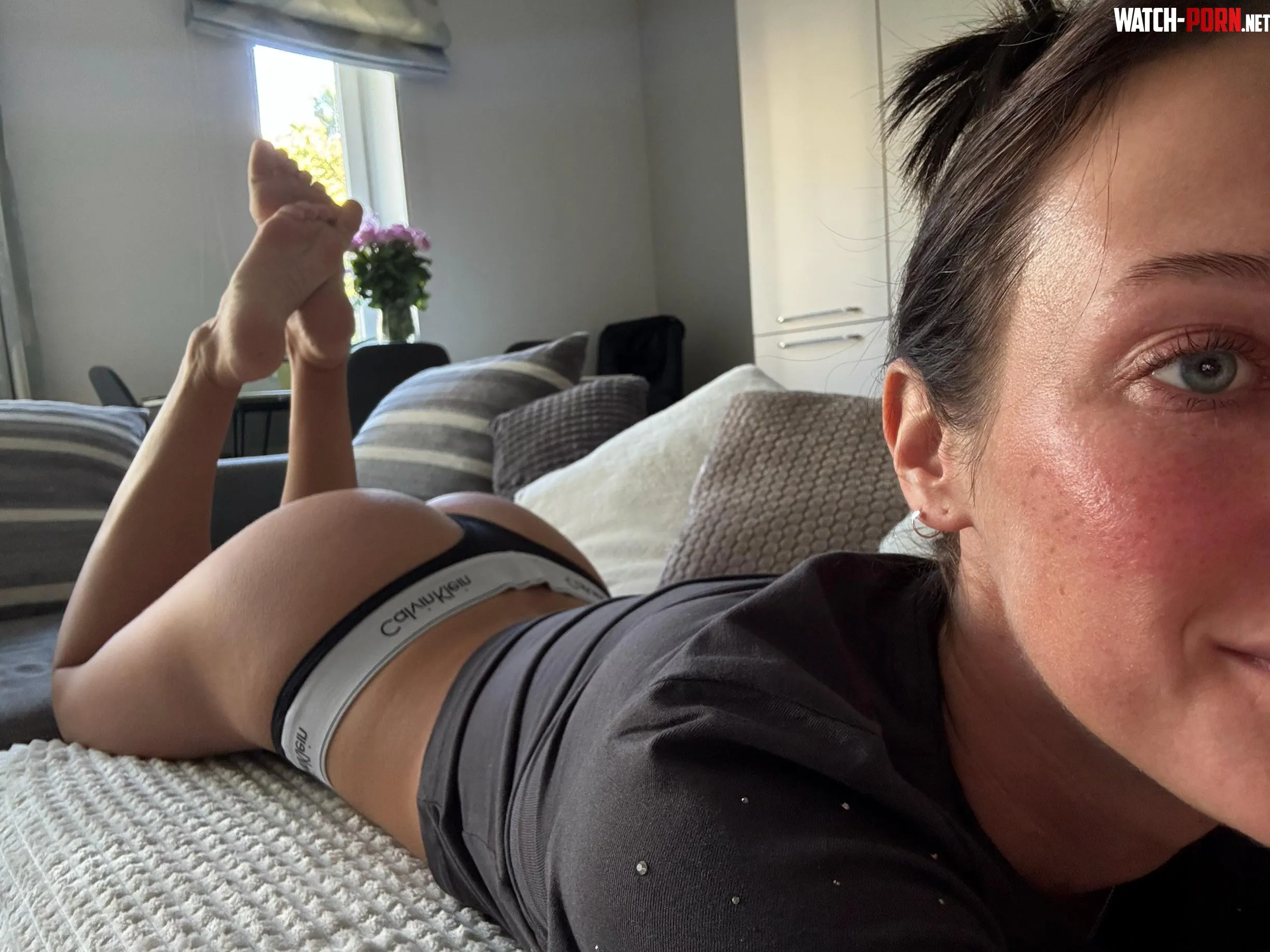 I have small freckles all over me.. by TheEmilyXrose