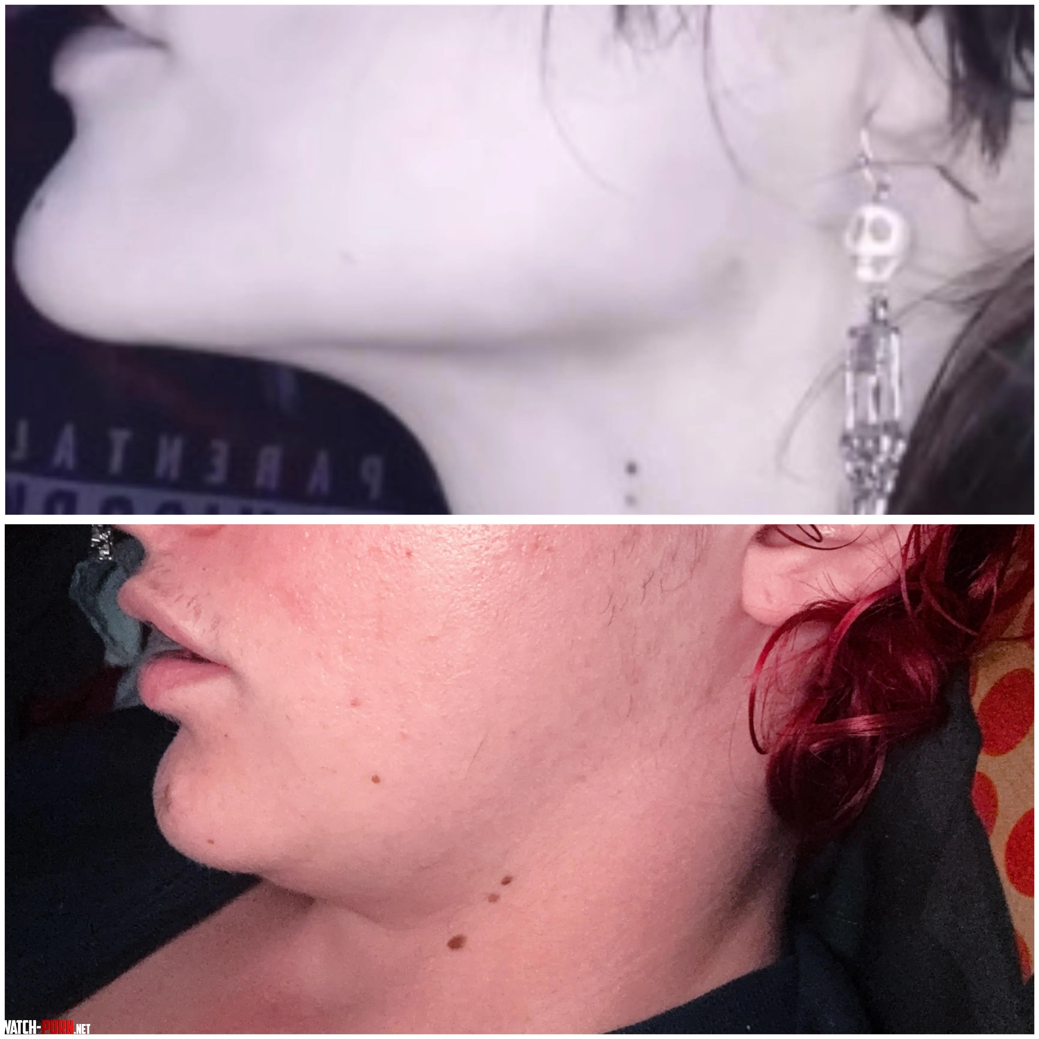 i’ve always been praised for my sharp jawline by transbon3s