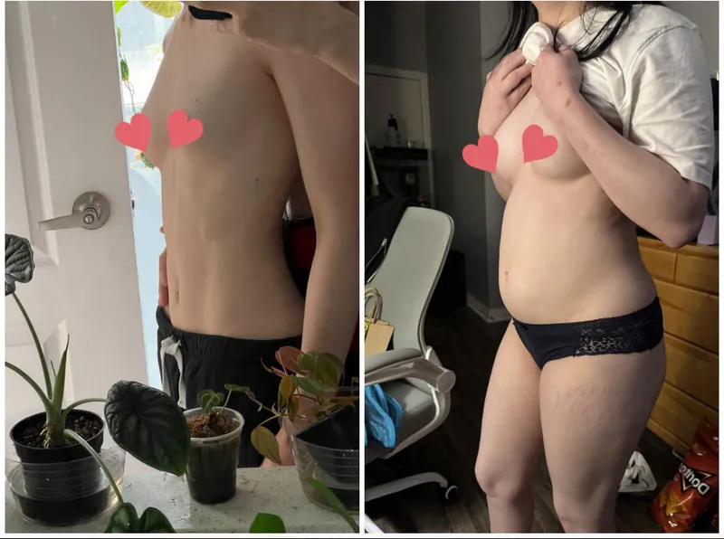 Thumbnail Growingcanadiangirl's Nightly Ritual: Embracing Stretchmarks