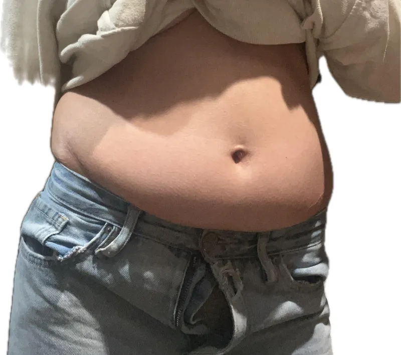 Thumbnail Dealing with Bloated Belly Issues by ballooningg