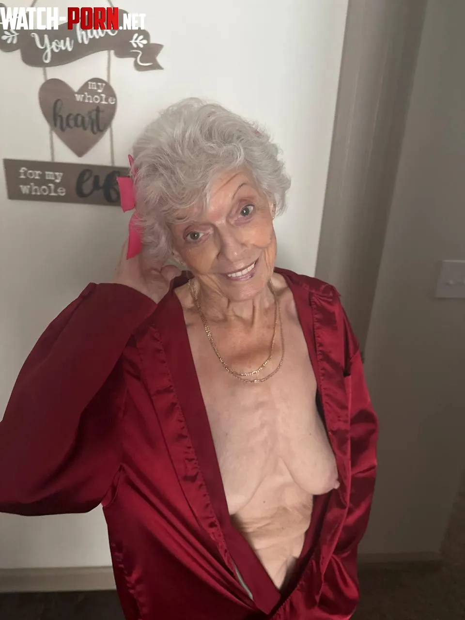 85yo and completely naked... Yes or no? by Used-Newspaper1705