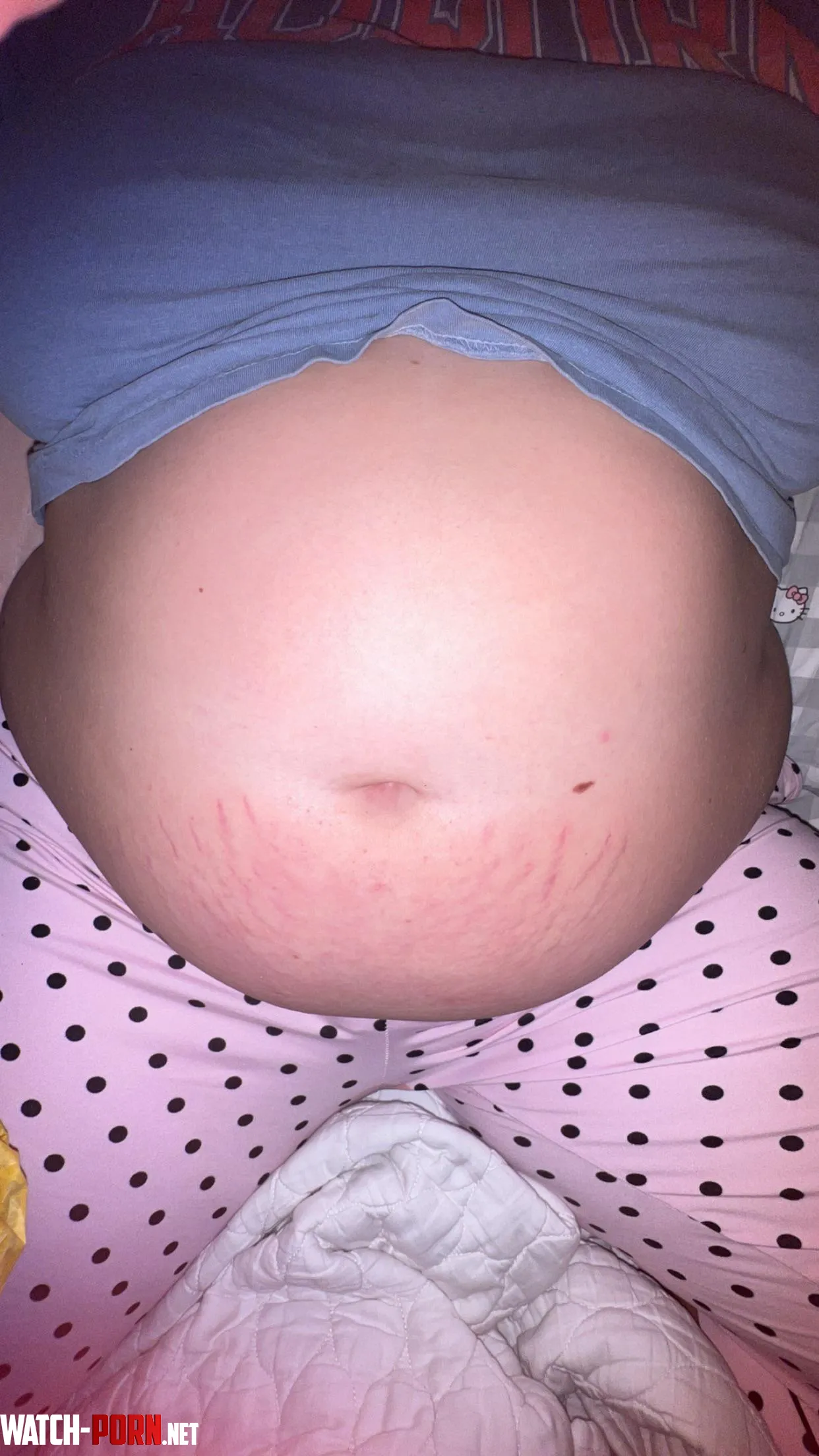 New stretch marks 🤩 by Key-Cash9988