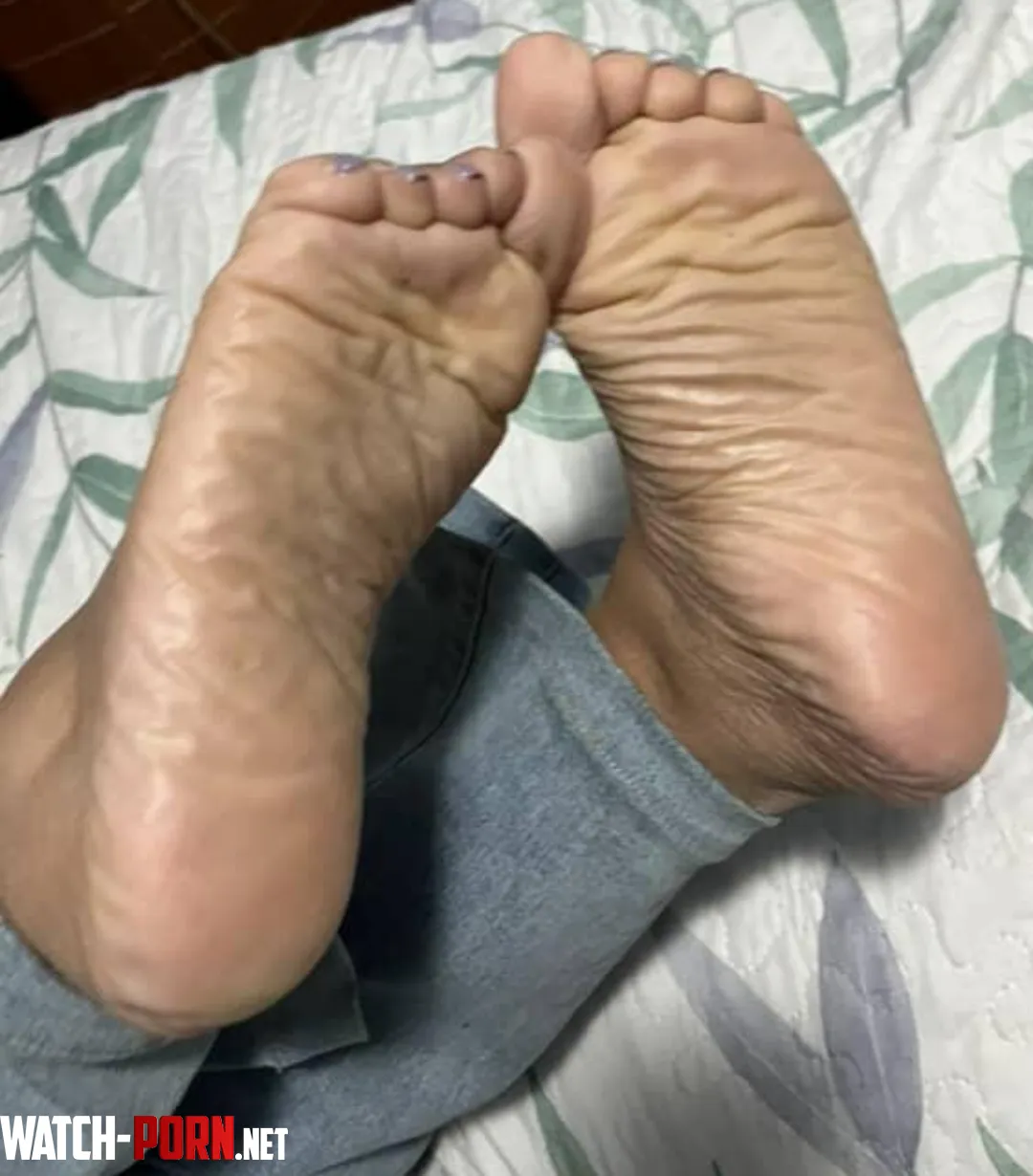 Look at the soles of my feet. You're on Wrinkle counting duty today by arboldebolas