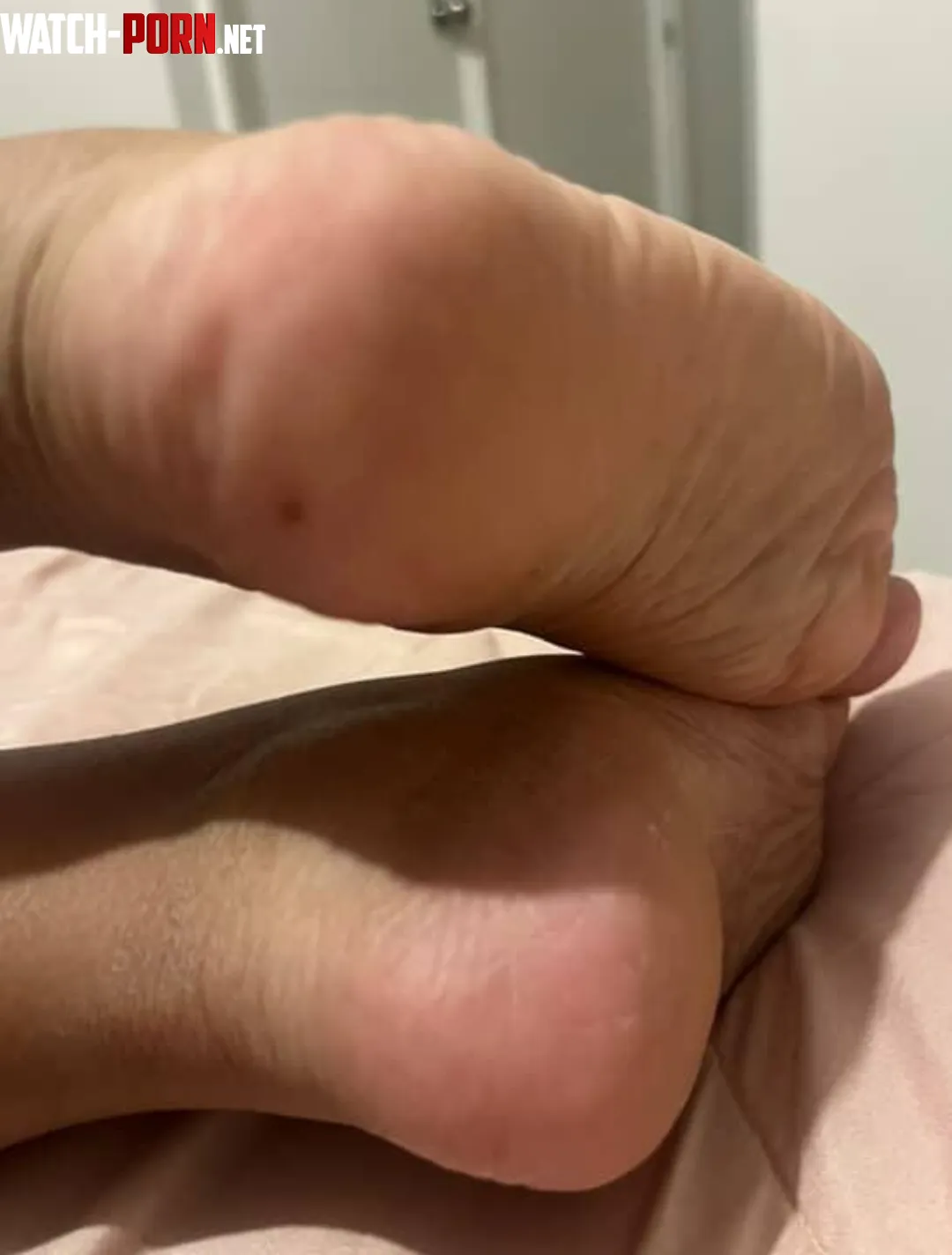 These heels need moisturizing. How would you help me by arboldebolas