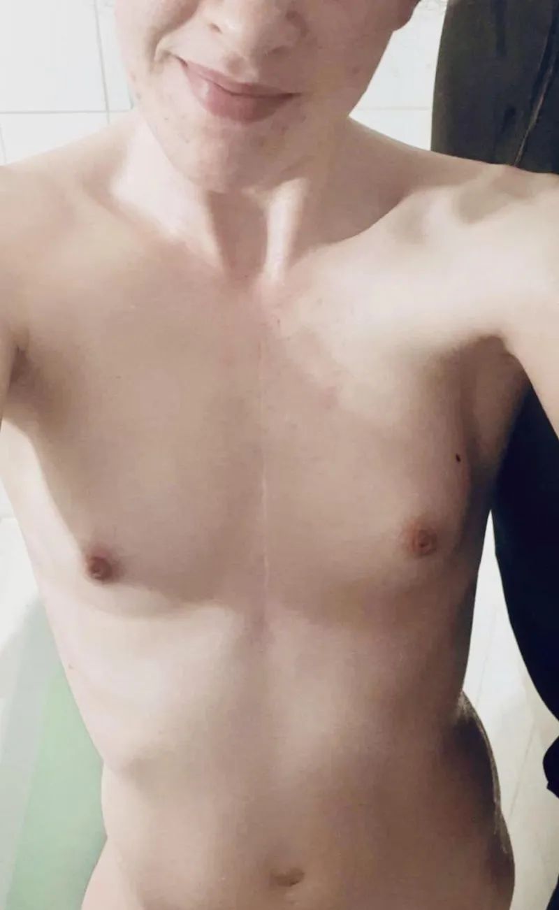 Thumbnail Used to get teased, but I’m so happy with them now! by Klutzy_Engineer_6558