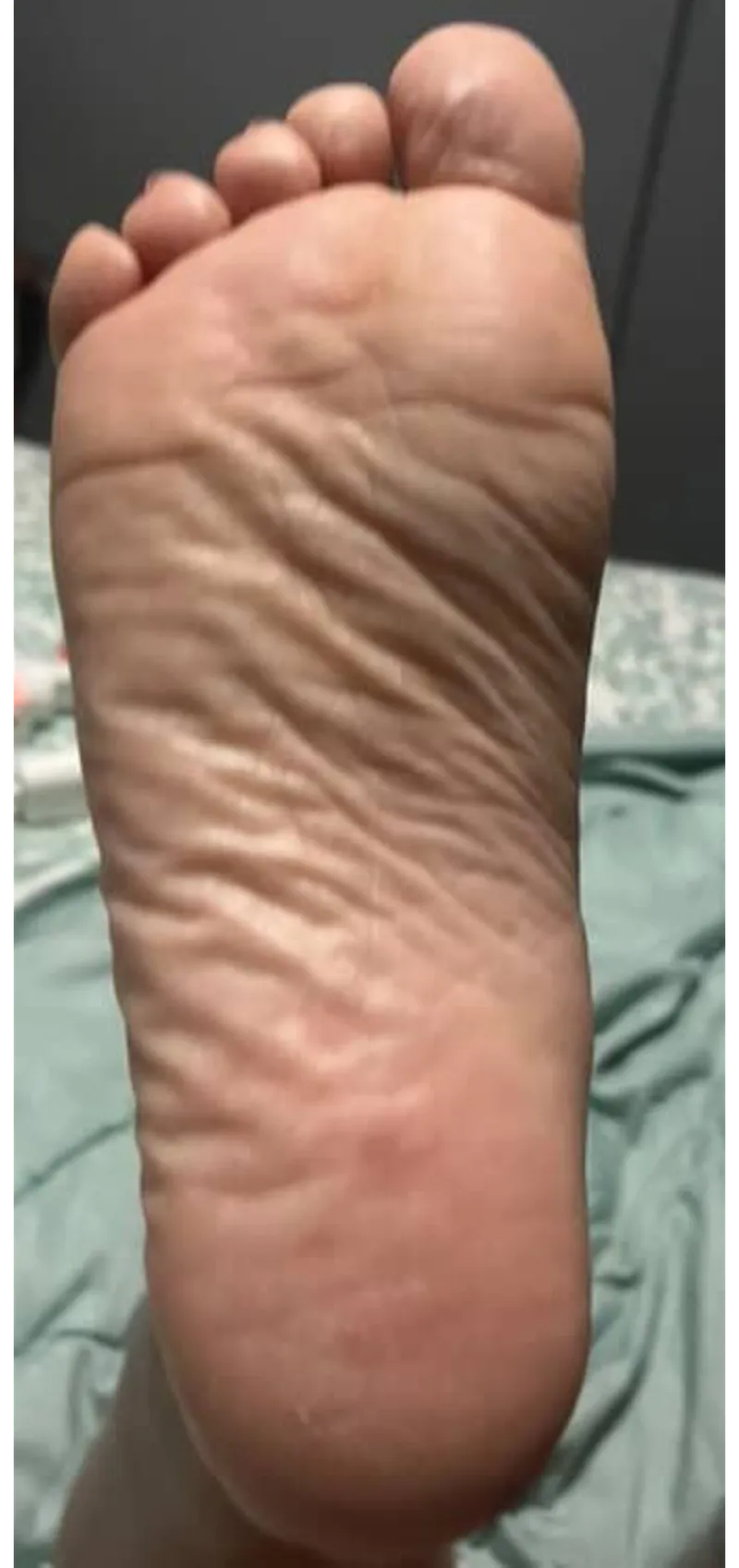 Thumbnail Wrinkly Sole Delight: arboldebolas' Foot Fetish Fantasy