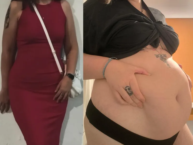 Thumbnail Revealing Transformations: Returning to Show Change with Mediocre_Explorer_47