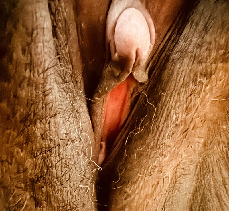 Thumbnail Extreme Close-ups: My Clit Journey by Mountain-Designer181