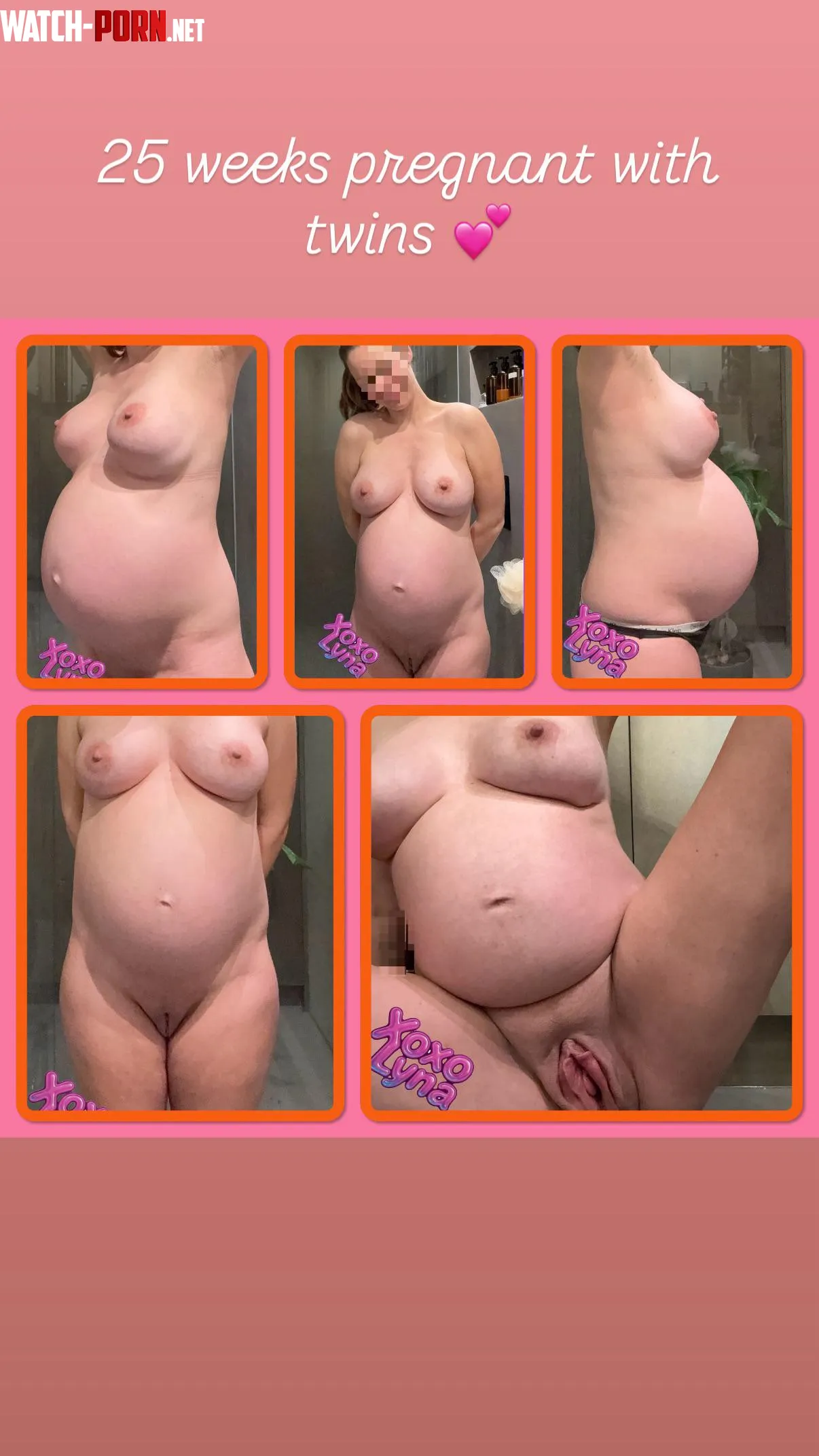 25 weeks pregnant with twins 💕 by XoxoLyna