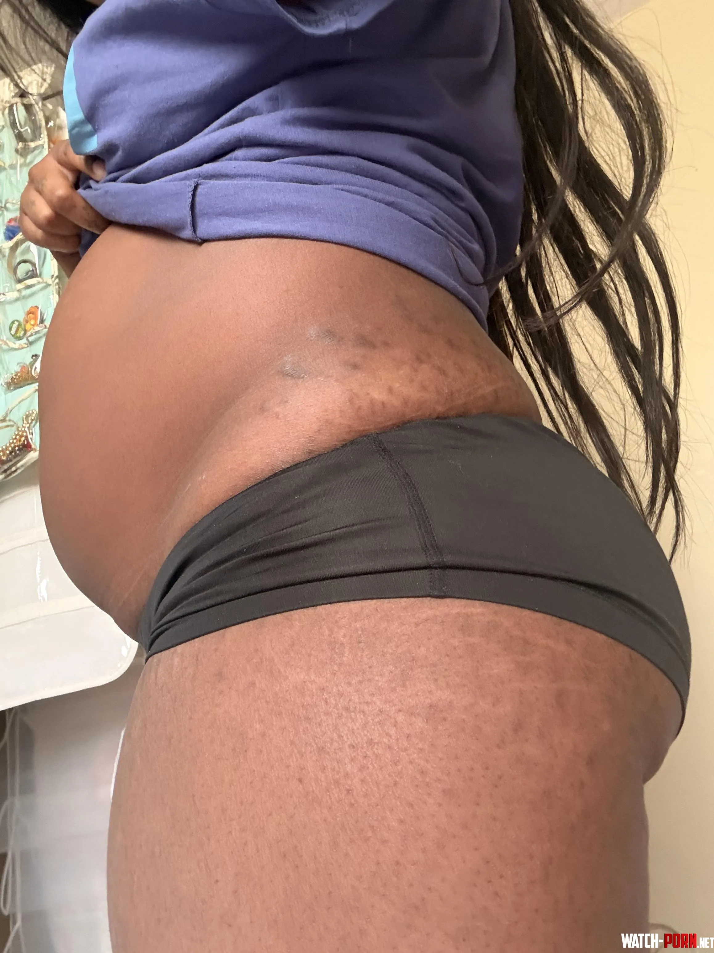 Stretch marks are the result of staying well fed :) by bxbun