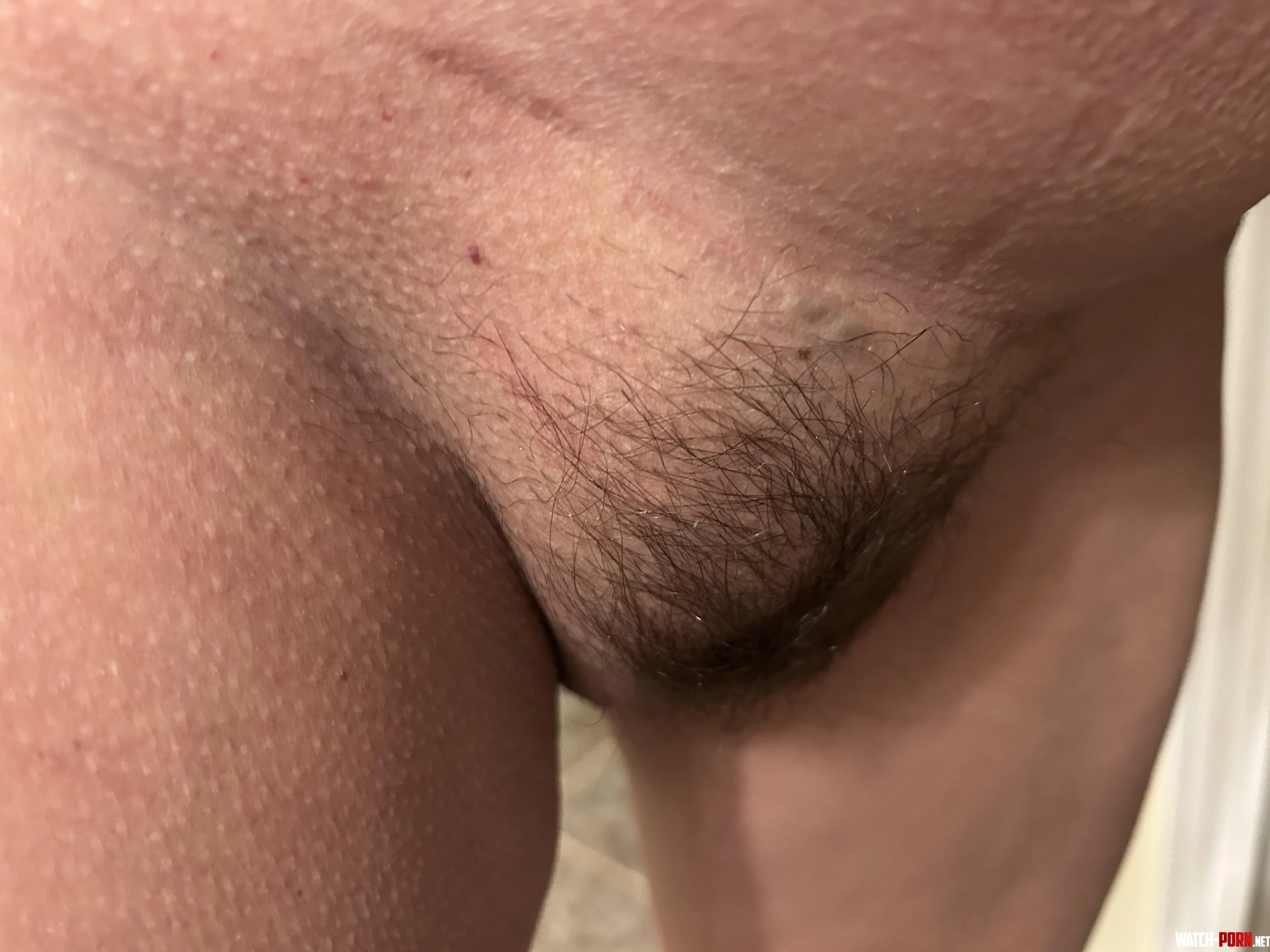 Hairy mound !!! by Substantial_Syrup441