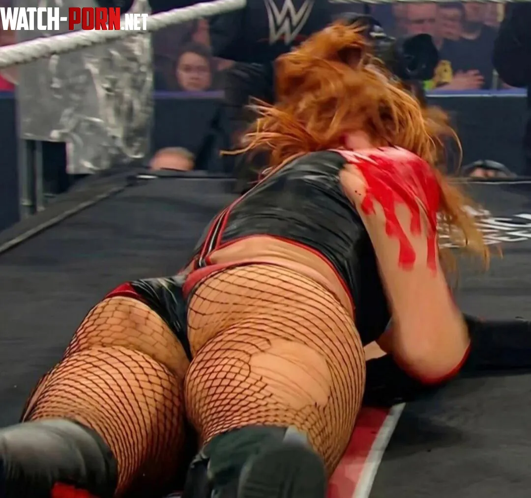 Becky Lynch by BeckyLynchIsBetter