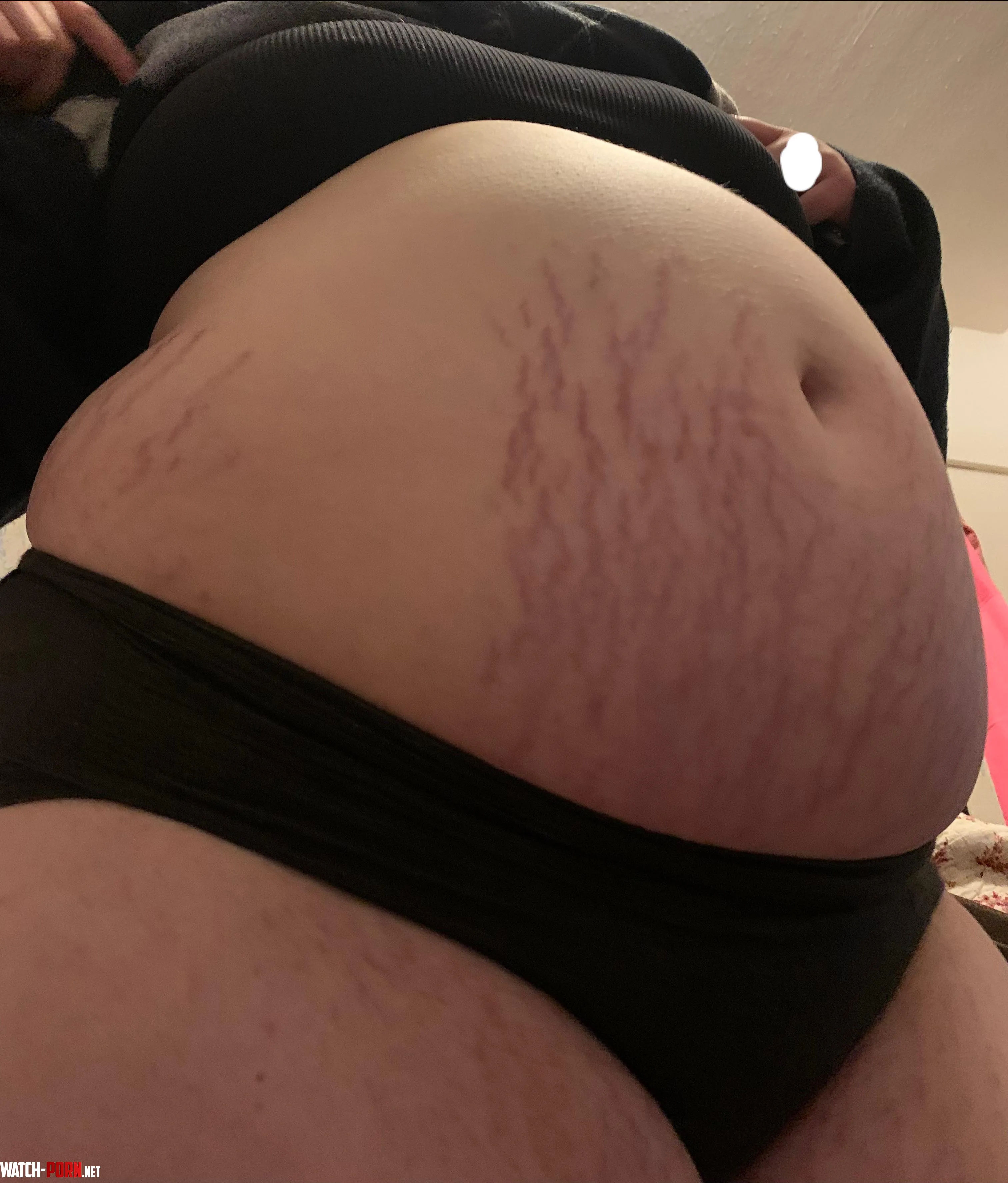 So what if I’ve gained weight? 🐷 by bra1nr0tt3np1ggy