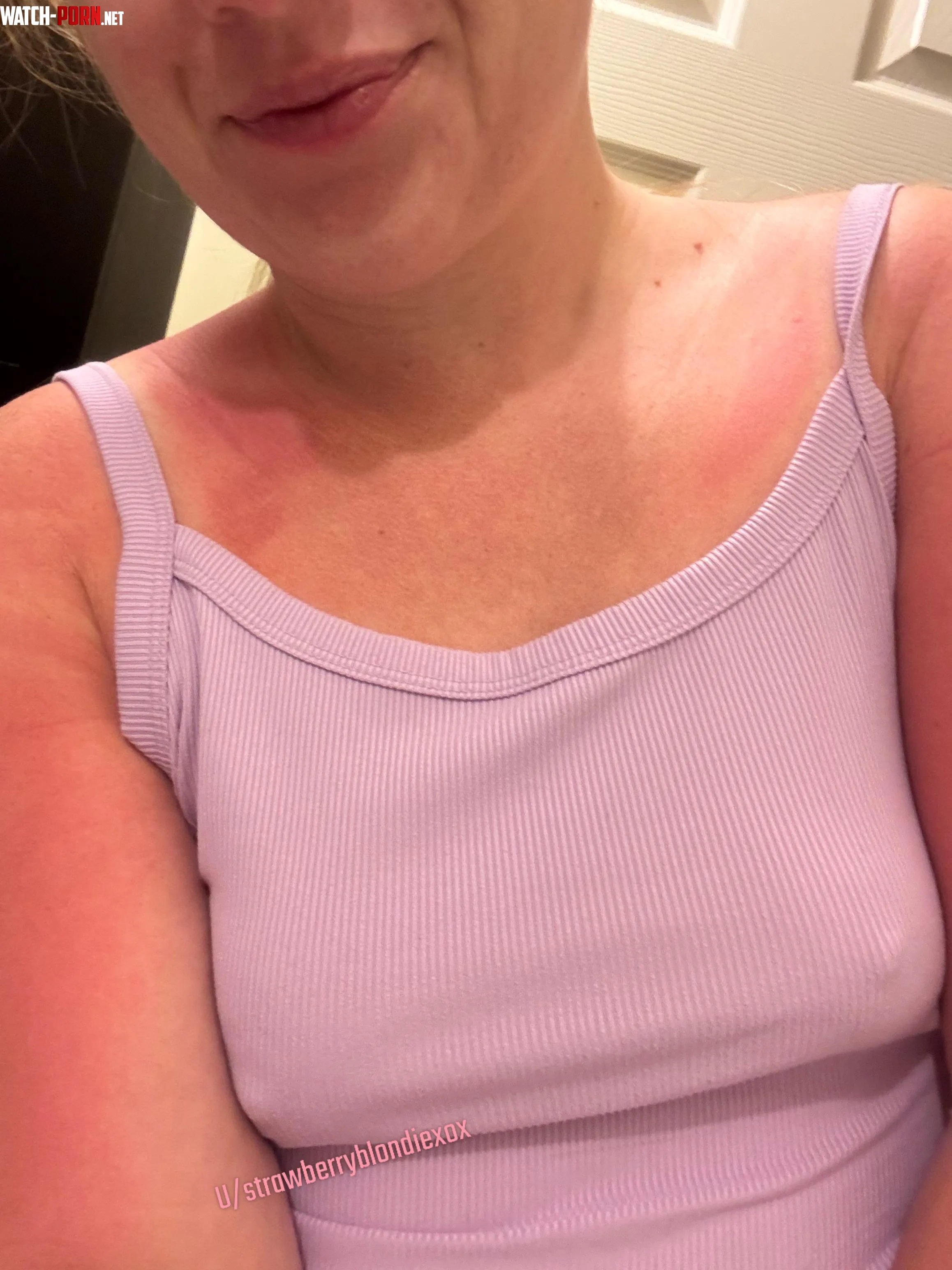 Braless & Sunburnt! by StrawberryBlondiexox