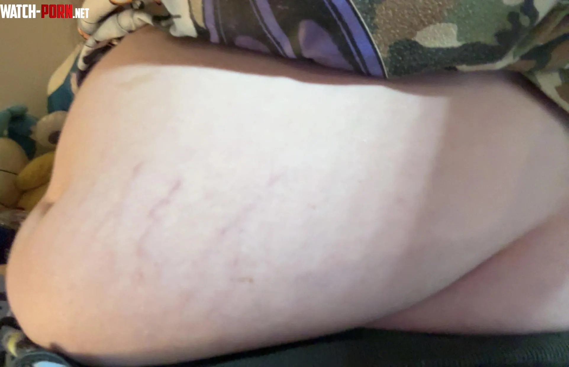 Stomach literally bulging on empty 😩 by Livid-Protection-314