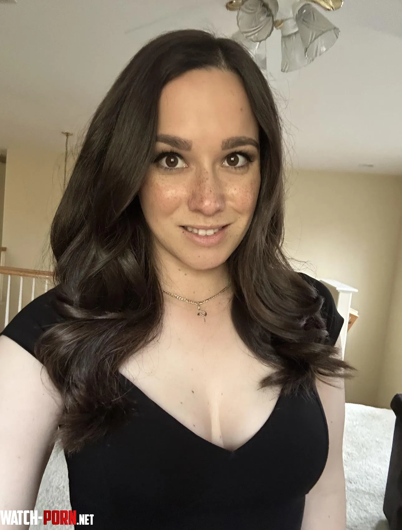 Freckles on freckles on freckles. by AlanaAraya