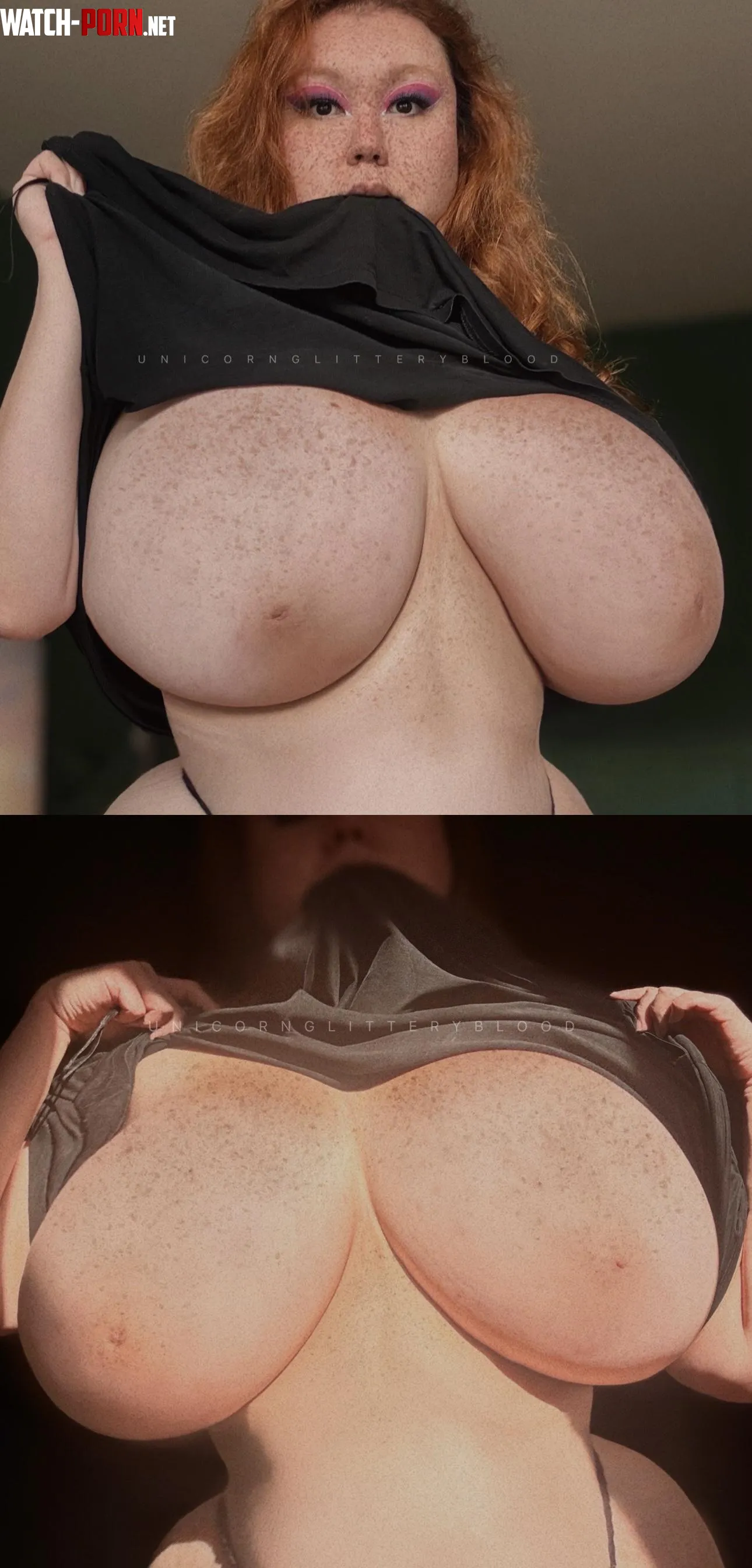 my freckles need icing by Unicornglitteryblood