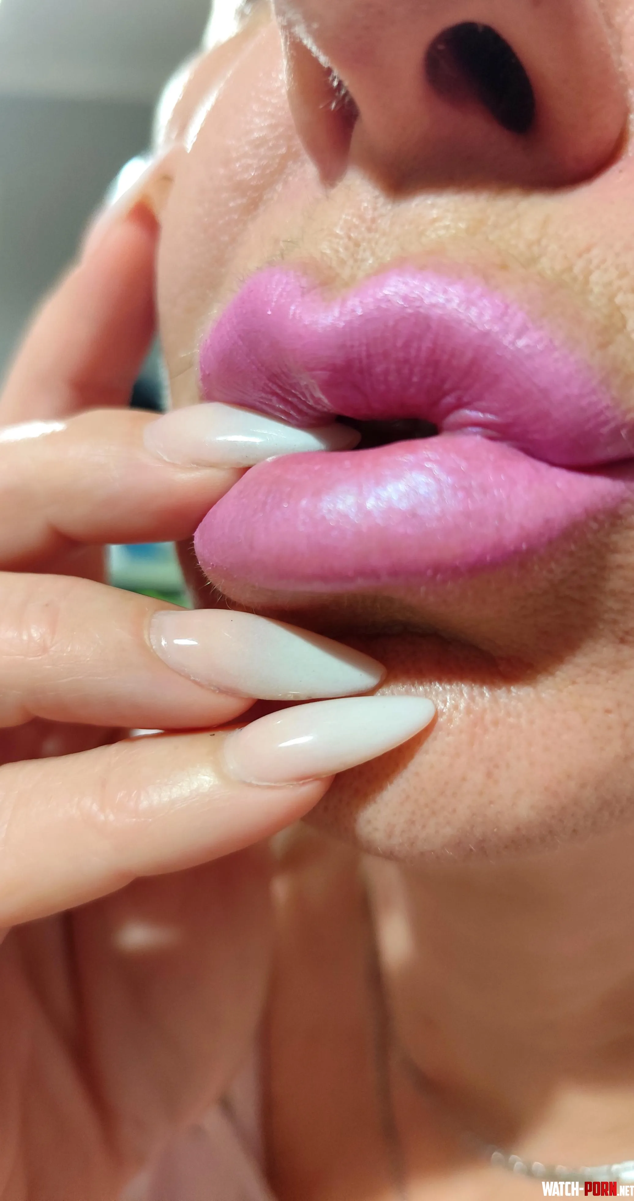 Filled lips? Done by Elis_Adams