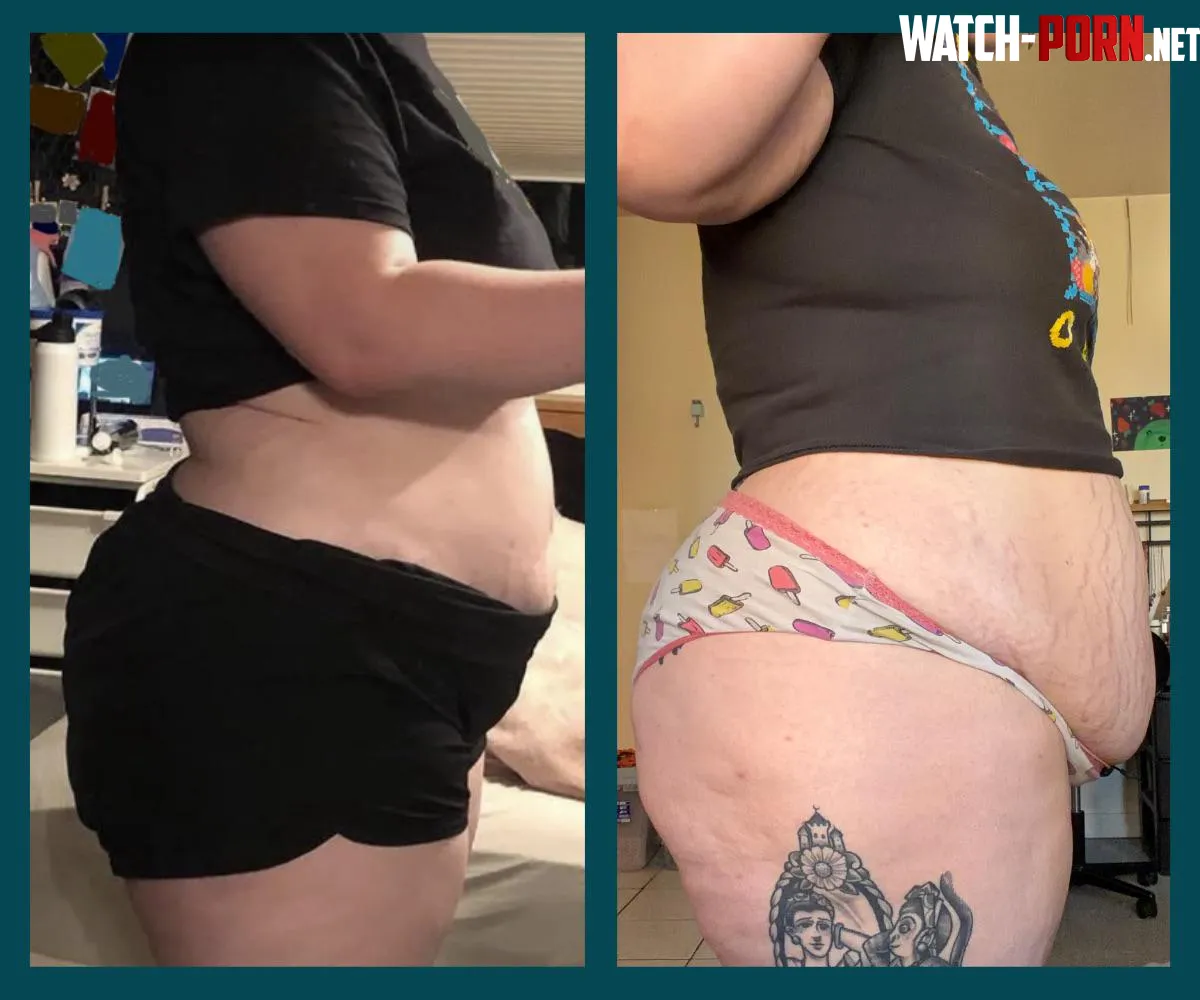 Peep the stretch marks by trianglesorn